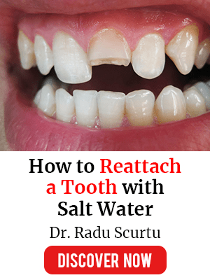 person with broken tooth